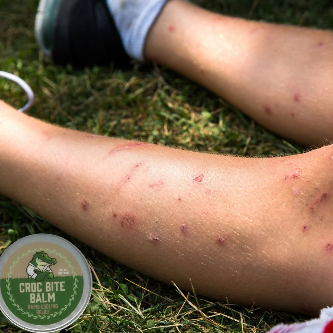 Croc Bite Balm -Natural Bite & Itch Relief 40g Body Dr Croc